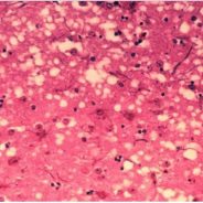 Scrapie Confirmed in a Hartley County Sheep