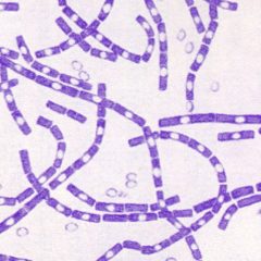 Texas State Veterinarian Encourages Vaccination Against Anthrax