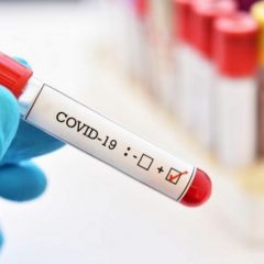 Dec. 16 COVID-19 Update: 2 Recoveries, 10 New Molecular Cases, 22 Probable Cases